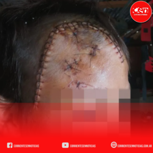 Tremenda egresión a un niño en la loclaidad de mercedes