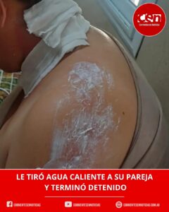 Violencia de género en La Leonesa: una joven fue atacada con agua caliente y detuvieron a su pareja