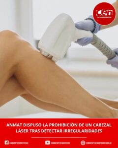 ANMAT prohibió un cabezal de depilación láser Soprano por riesgo de quemaduras e intervino la Justicia